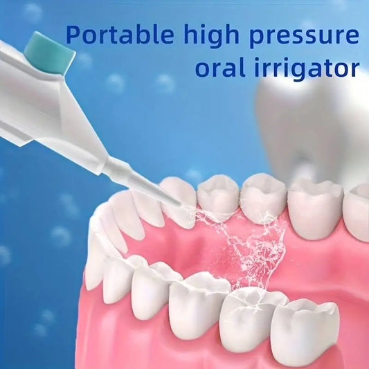 "High Pressure Oral Irrigator – Portable Dental Floss Cleaner" ✅