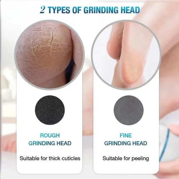 ⭐⭐⭐⭐ (36 Reviews)✨ Back Callus Remover – Electric Foot Grinder with Vacuum & Rechargeable Pedicure Tool