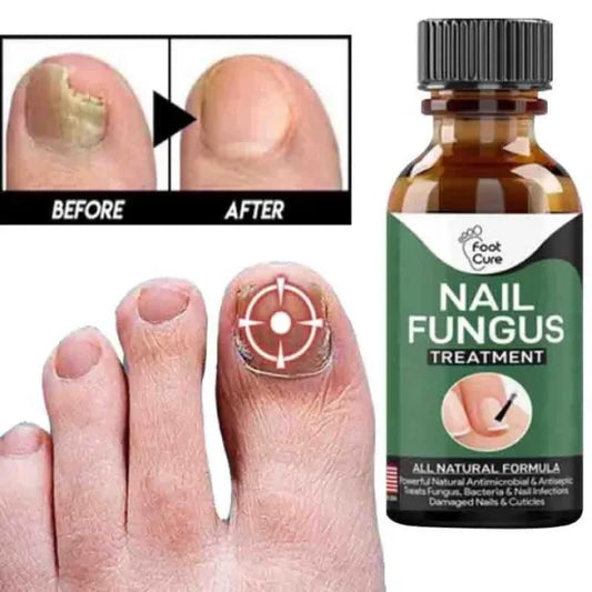 ⭐⭐⭐⭐⭐ (350+ Reviews) 🌿 Fast Nail Fungal Treatment – 💅 Nail Repair Essence Serum | Foot & Hand Fungus Removal Gel