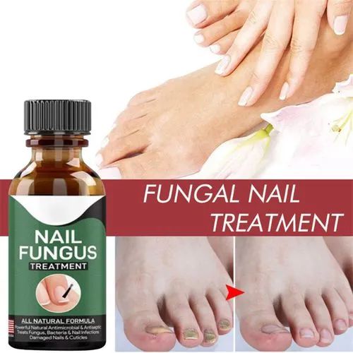 ⭐⭐⭐⭐⭐ (350+ Reviews) 🌿 Fast Nail Fungal Treatment – 💅 Nail Repair Essence Serum | Foot & Hand Fungus Removal Gel